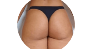 gluteo